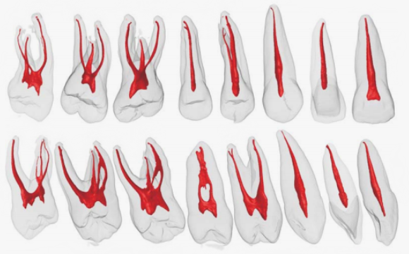 Форма каналов зубов верхней челюсти