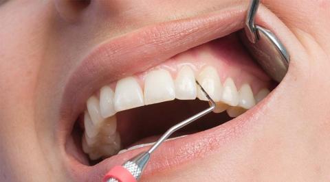 Лечение дёсен в Нашгороде