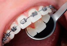 Ортодонтическое отделение стоматологии Ортодонтическое отделение